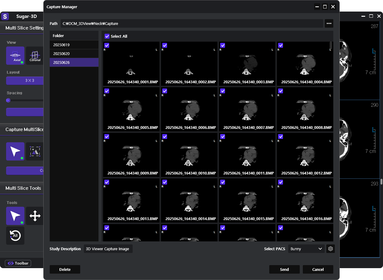 DICOM Capture & Transfer