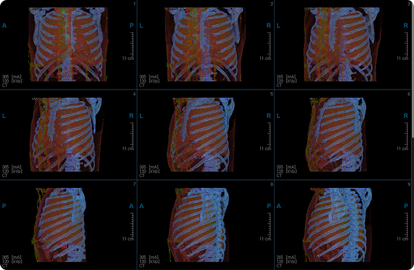 3D Multi Rotate View