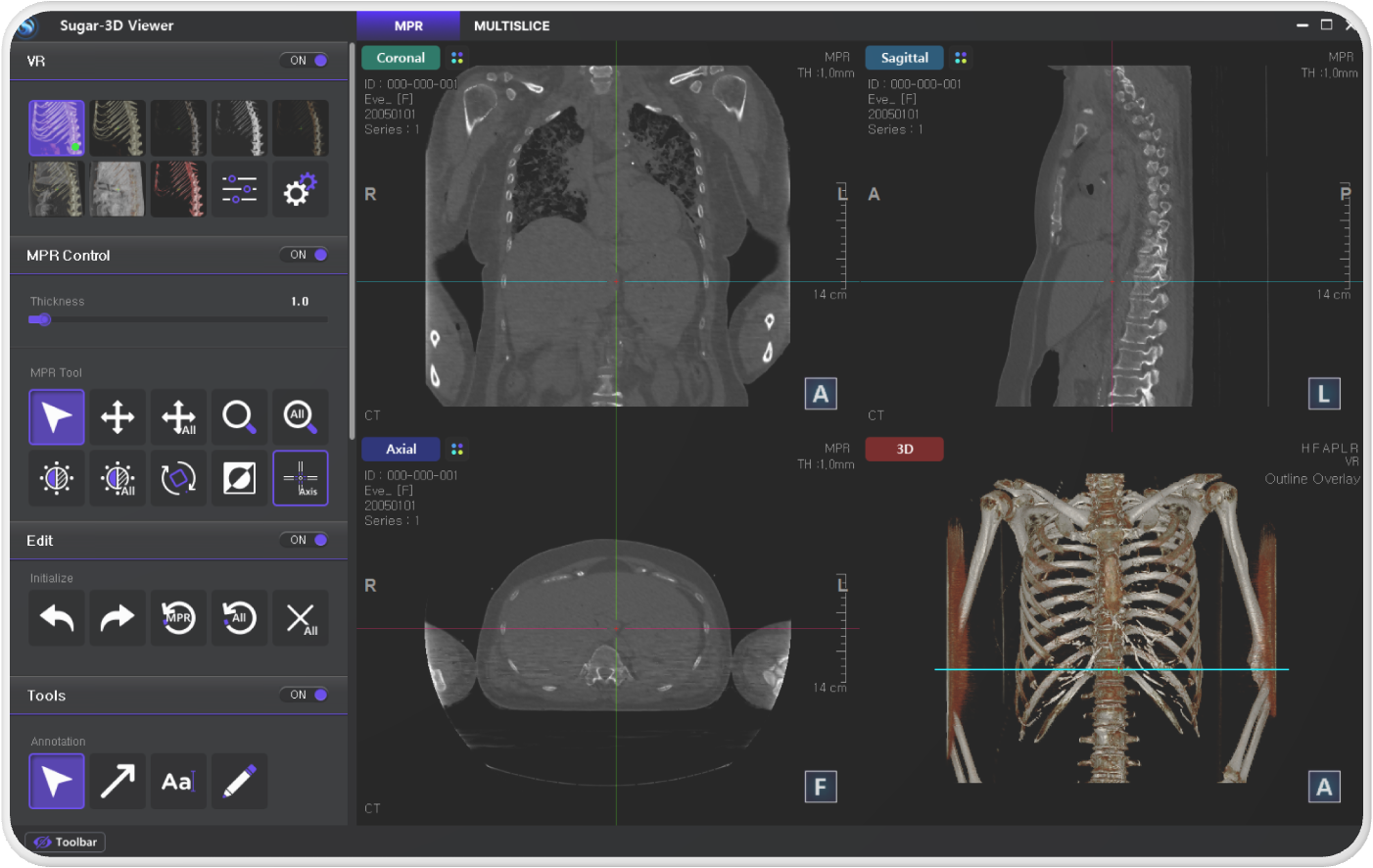 Immersive 3D Visualization