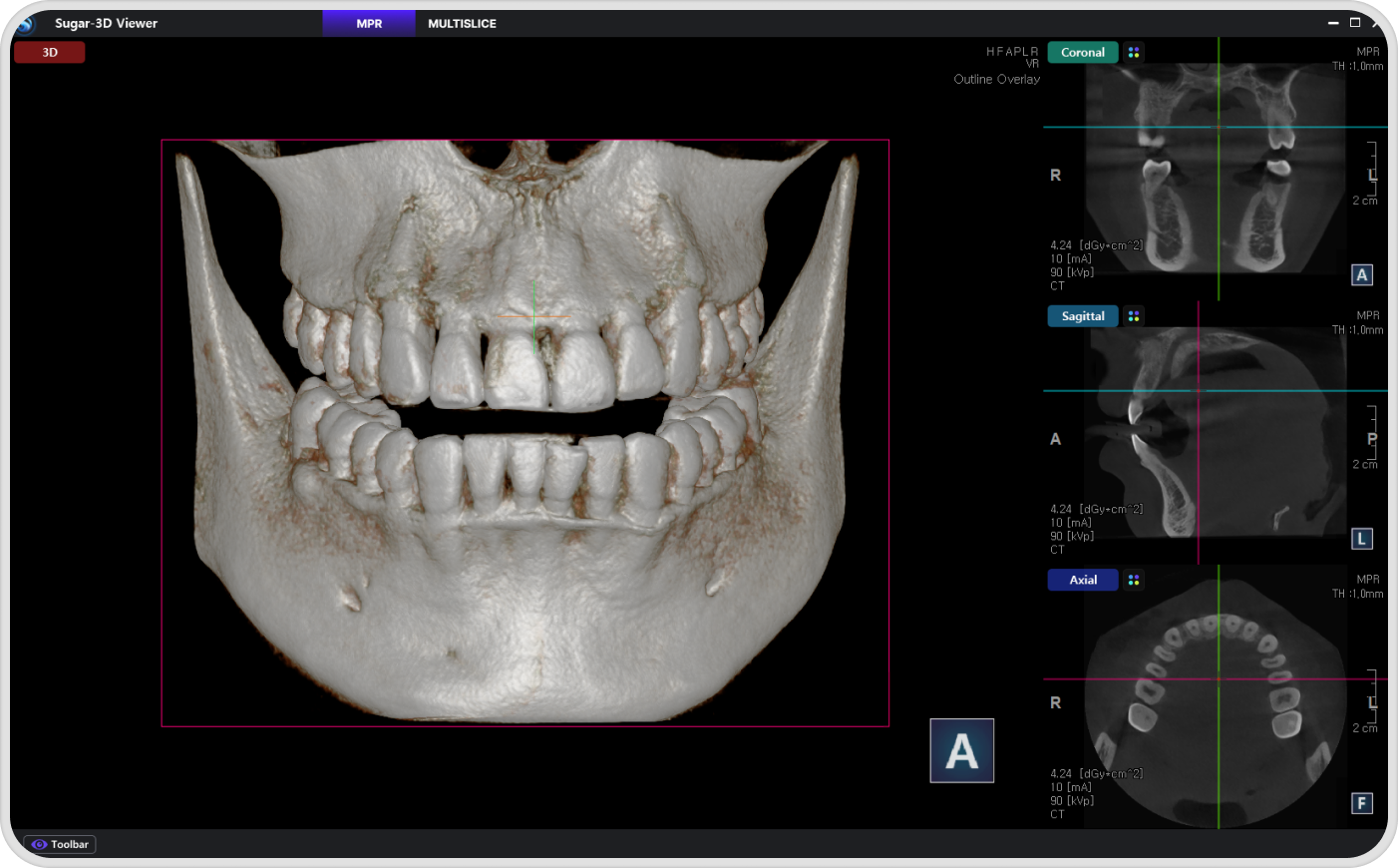 High-Resolution 3D Scanning and Rendering