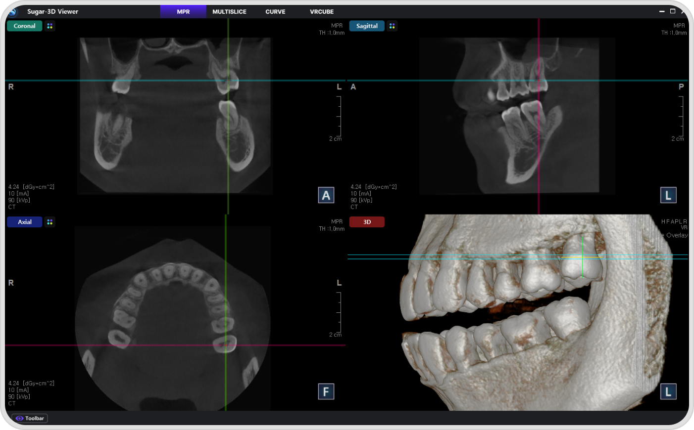 MPR and Measurement Tools